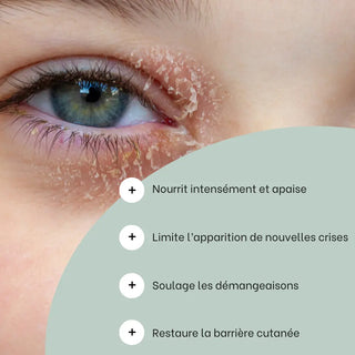 bienfaits-routines-eczema-des-paupieres