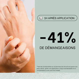 moins-de-demangeaisons-eczema-des-mains